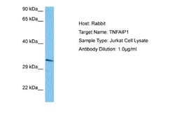 TNFAIP1 Rabbit anti-Human, Polyclonal, Novus Biologicals 0.1 mL | Buy Online | Novus Biologicals | Fisher Scientific